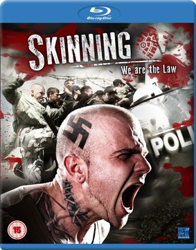 Skinning - We Are The Law